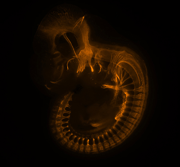 This embryonic mouse at day 10.5 has a special glow thanks to the fluorescent labeling of its neurofilaments, which are major structural element of neurons. The picture won the July 2013 Image of the Month contest at the Eli and Edythe Broad Center for Rengerative Medicine and Stem Cell Research at USC. (Image by Elisabeth Rutledge, PhD student in the lab of Andrew McMahon)