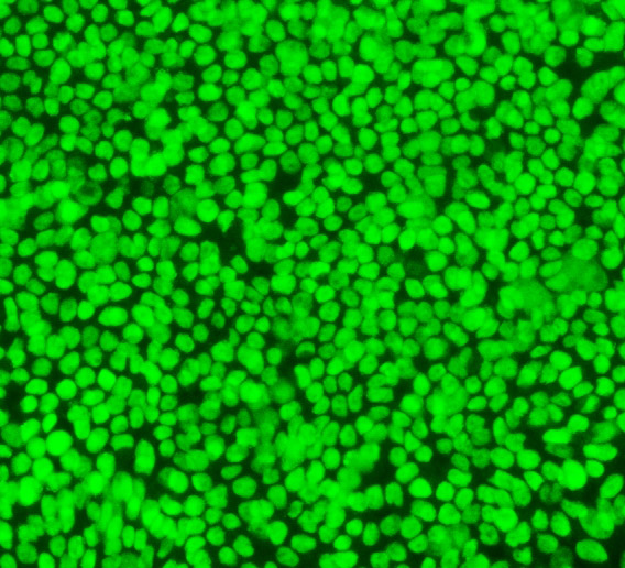 Embryonic stem cells (Image/courtesy of Qi-Long Ying)