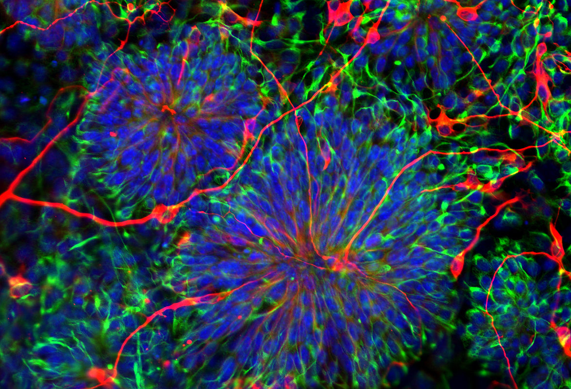 The gene Prkci promotes the generation of differentiated cells (red). However if Prkci activity is reduced or absent, neural stem cells (green) are promoted. (Image by In Kyoung Mah)