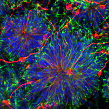 Embryonic stem cells that have differentiated into neurons (Image by In Kyoung Mah/Mariani Lab)