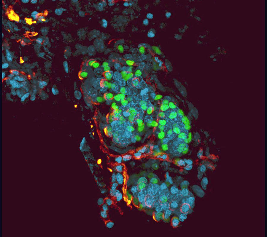 Staining of slow-cycling sweat gland cells (green) with the protein laminin (red) and the fluorescent stain DAPI (blue) (Image by Yvonne Leung)