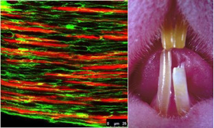 The inferior alveolar nerve provides a niche for stem cells that maintain incisor homeostasis. When the nerve is severed, homeostasis is disrupted and within one month the affected incisor becomes chalky and breaks. (Photos/courtesy of Center for Craniofacial Molecular Biology)