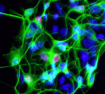 Motor neurons derived from an ALS patient (Image courtesy of the Ichida Lab)