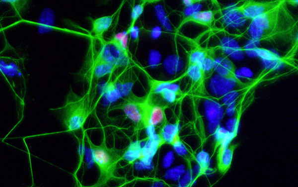Motor neurons derived from an ALS patient (Image courtesy of the Ichida Lab)