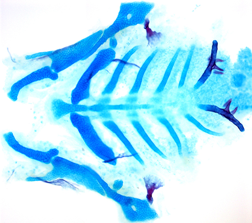 Dissection of the larval zebrafish skeleton shows facial cartilage (blue) and bone (red) (Image courtesy of the Crump Lab)