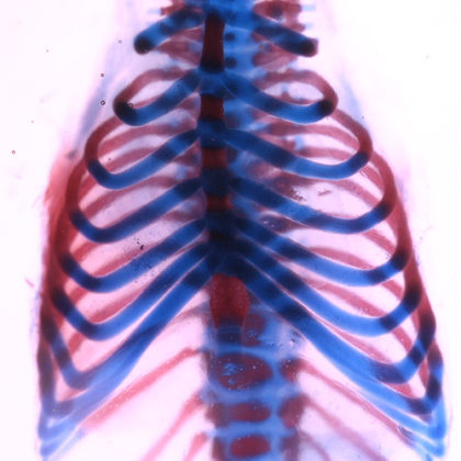 Mouse rib cage stained to show cartilage (blue) and bone (red). In adult mice, surgically removed sections of either portion can fully regenerate. (Image by Francesca Mariani)