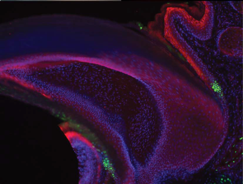 Stem cells in a mouse nail (Image courtesy of the Krzysztof Kobielak lab)