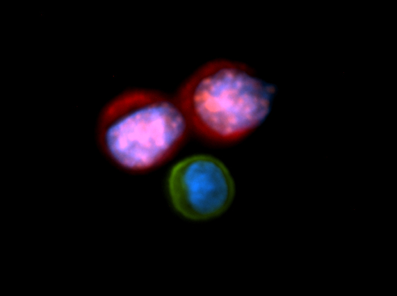 Circulating tumor cells (Image courtesy of Min Yu)