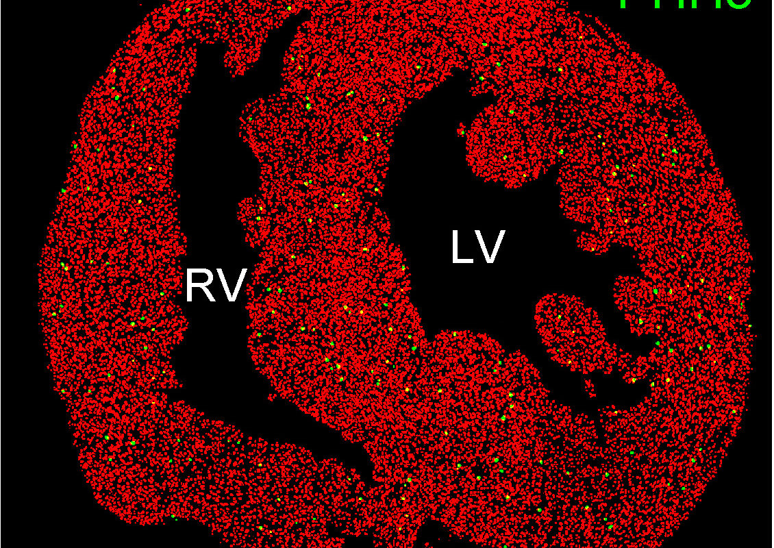 Neonatal mouse heart showing basal level of proliferating cardiomyocytes (red: cardiomyocytes; green: proliferating cardiomyocytes; RV: right ventricle; LV: left ventricle). (Image courtesy of Ellen Lien)