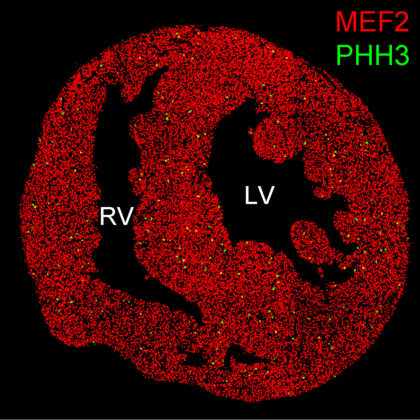 Neonatal mouse heart showing basal level of proliferating cardiomyocytes (red: cardiomyocytes; green: proliferating cardiomyocytes; RV: right ventricle; LV: left ventricle). (Image courtesy of Ellen Lien)
