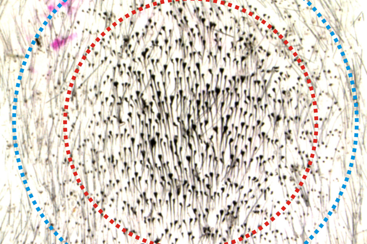 Quorum sensing in hair population regeneration (Image courtesy of Cheng-Ming Chuong)