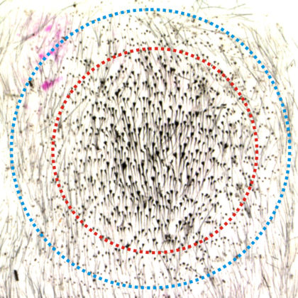 Quorum sensing in hair population regeneration (Image courtesy of Cheng-Ming Chuong)