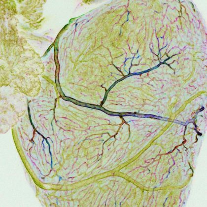 Coronary vasculature in zebrafish (Image courtesy of Children's Hospital Los Angeles)