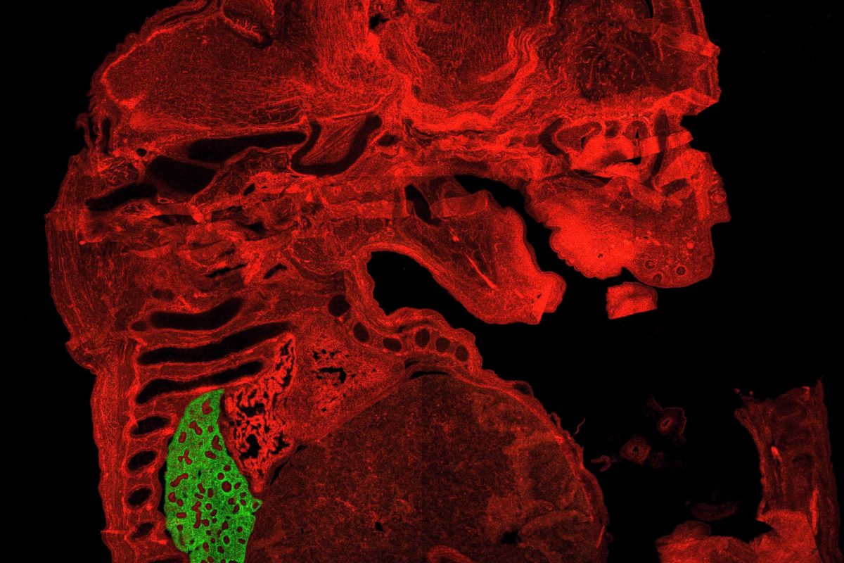 Transgenic mouse model used to target lung mesenchymal cells (green) (Image courtesy of Children's Hospital Los Angeles)