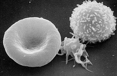From left to right, a red blood cell, a platelet and a white blood cell (Public domain image courtesy of the Electron Microscopy Facility at The National Cancer Institute at Frederick)