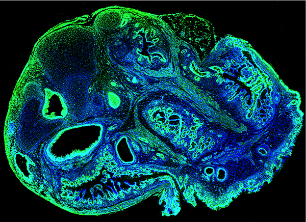 Cerebral organoid derived from ALS patient stem cells (Image by Lisa Nguyen, Yaoming Wang and Angeliki Nikolakopoulou)