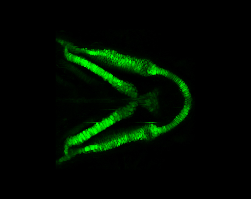 Developing zebrafish skeleton showing a gene called Sox9 (green) in cartilage-producing cells. (Image by Xinjun He/McMahon Lab)