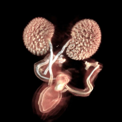 Kidney (Image by Lisa Rutledge and Seth Ruffins)