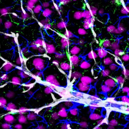Snapshot of a neurovascular unit, consisting of neurons (pink), astrocytes (blue), resident microglia (green), a penetrating arteriole and capillaries (white) (Photo courtesy of the Zlokovic Lab)