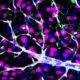 Snapshot of a neurovascular unit, consisting of neurons (pink), astrocytes (blue), resident microglia (green), a penetrating arteriole and capillaries (white) (Photo courtesy of the Zlokovic Lab)