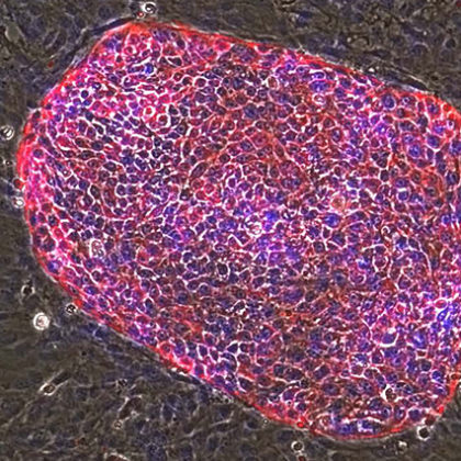 Liver stem cells (Image courtesy of Qi-Long Ying)