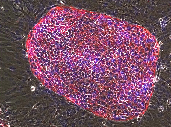 Liver stem cells (Image courtesy of Qi-Long Ying)