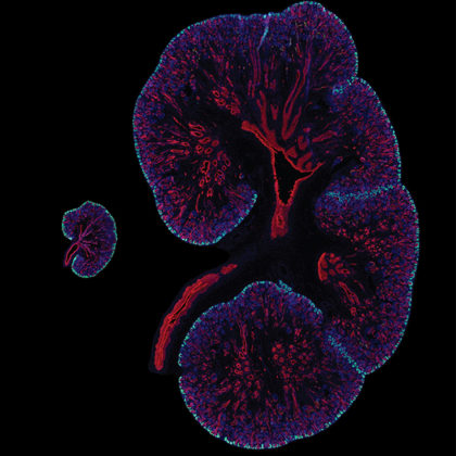 Embryonic day 15.5 mouse kidney next to a 15.5 week human fetal kidney with SIX2 (cyan) marking the nephron progenitors and cytokeratin (red) highlighting the collecting duct system. Nuclei are in blue. (Image by Lori O'Brien)