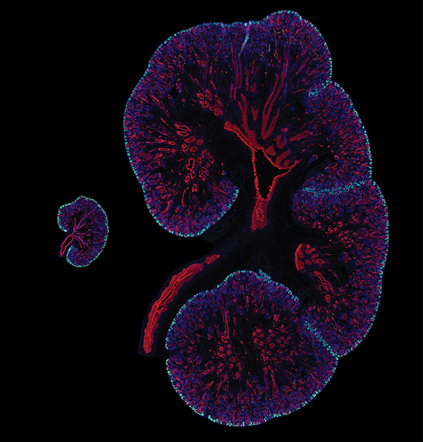 Embryonic day 15.5 mouse kidney next to a 15.5 week human fetal kidney with SIX2 (cyan) marking the nephron progenitors and cytokeratin (red) highlighting the collecting duct system. Nuclei are in blue. (Image by Lori O'Brien)