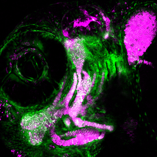 A three-day-old zebrafish head skeleton with newly differentiated cartilage cells (magenta) emerging from a pool of skeletal progenitor cells (green) (Image by Lindsey Barske)