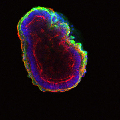 Stem cells self-organize to form a hollow ball of cells. (Image by In Kyoung Mah and Francesca Mariani)