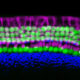 The organ of Corti, the hearing organ of the inner ear, is made up of a single row of inner hair cells and three rows of outer hair cells (green), surrounded by supporting cells (purple). (Image by Yassan Abdolazimi and Neil Segil)