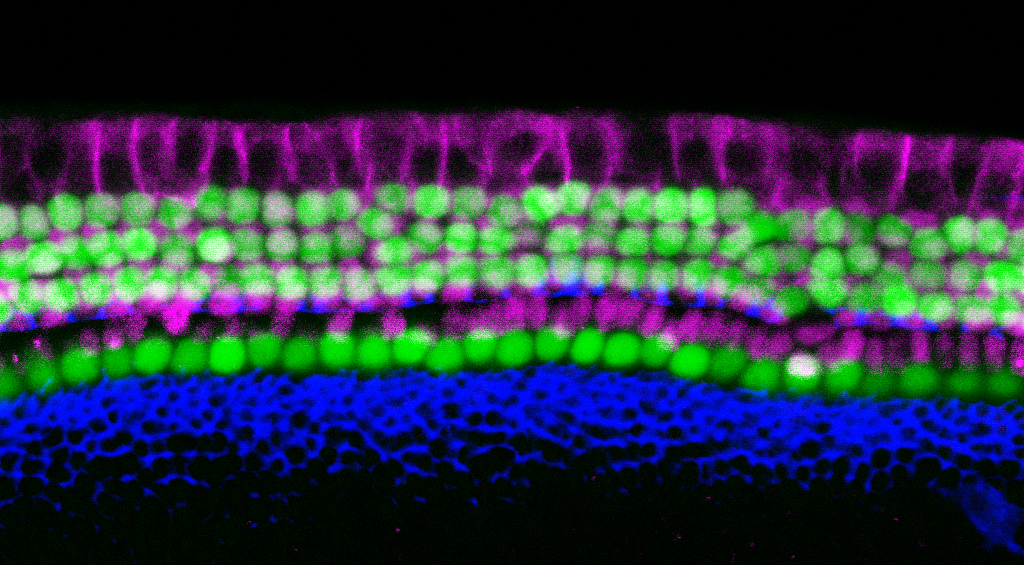 The organ of Corti, the hearing organ of the inner ear, is made up of a single row of inner hair cells and three rows of outer hair cells (green), surrounded by supporting cells (purple). (Image by Yassan Abdolazimi and Neil Segil)