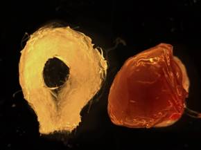 Biodegradable scaffold (left) and human tissue-engineered liver (right) (Photo courtesy of The Saban Research Institute at Children’s Hospital Los Angeles)