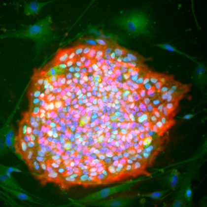 Stem cells (Image courtesy of Justin Ichida)