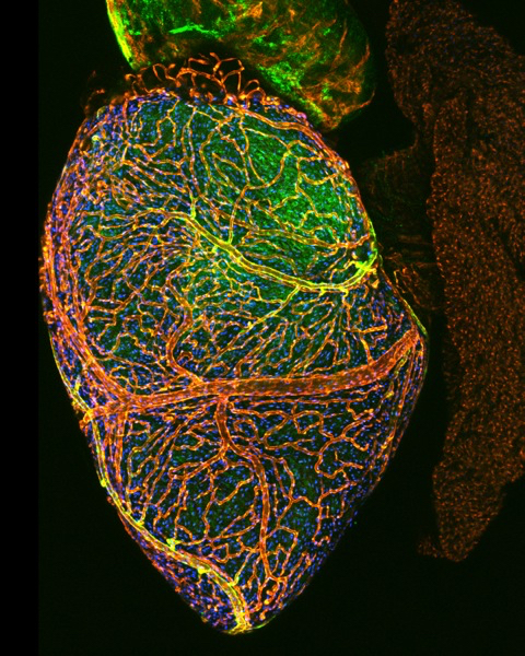 Zebrafish heart with coronary vessels (Image courtesy of Ellen Lien/Children's Hospital Los Angeles)