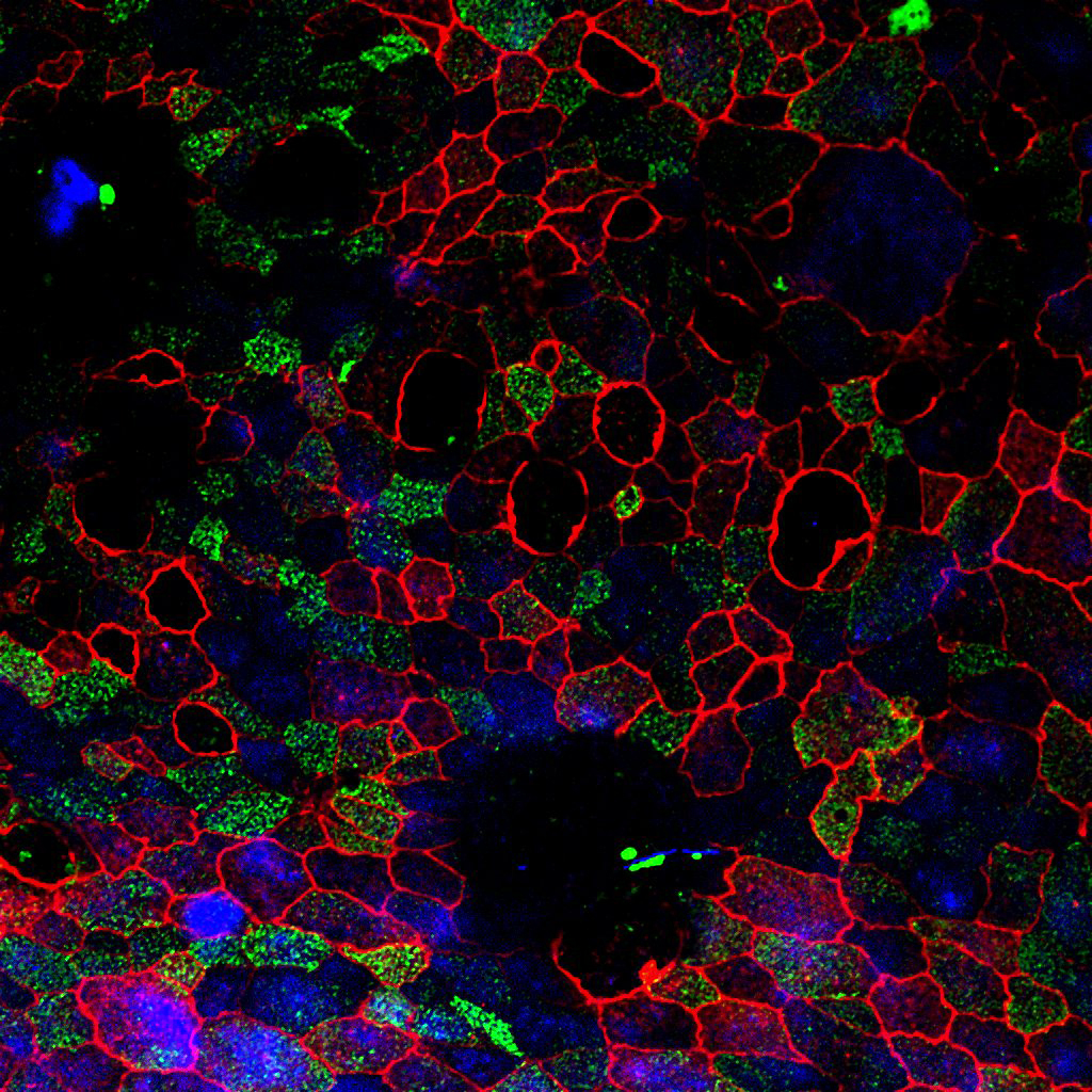 Featured Research - Heart, Lung And Blood - Usc Stem Cell