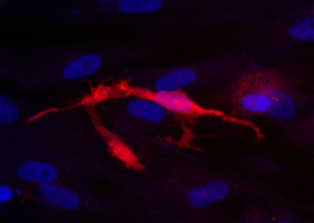 Microglia, or immune cells in the brain, could play a role in Alzheimer’s disease. (Image by Valerie Hennes/Ichida Lab)