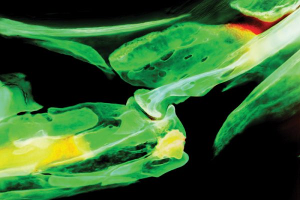 A zebrafish jaw joint holds lessons about stem cells and development. (Image by Amjad Askary/Gage Crump Lab)