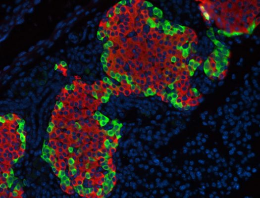 Pancreatic cells that regulate blood sugar (Image by Senta Georgia)