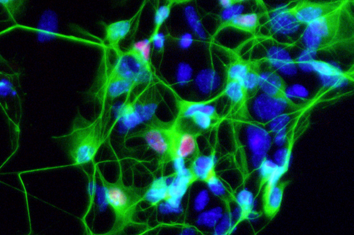 Motor nerve cells (Image courtesy of the Ichida Lab)