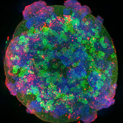 Kidney organoid (Image by Tracy Tran/McMcMahon Lab)