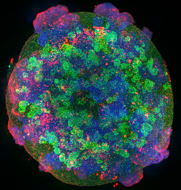 Kidney organoid (Image by Tracy Tran/McMcMahon Lab)