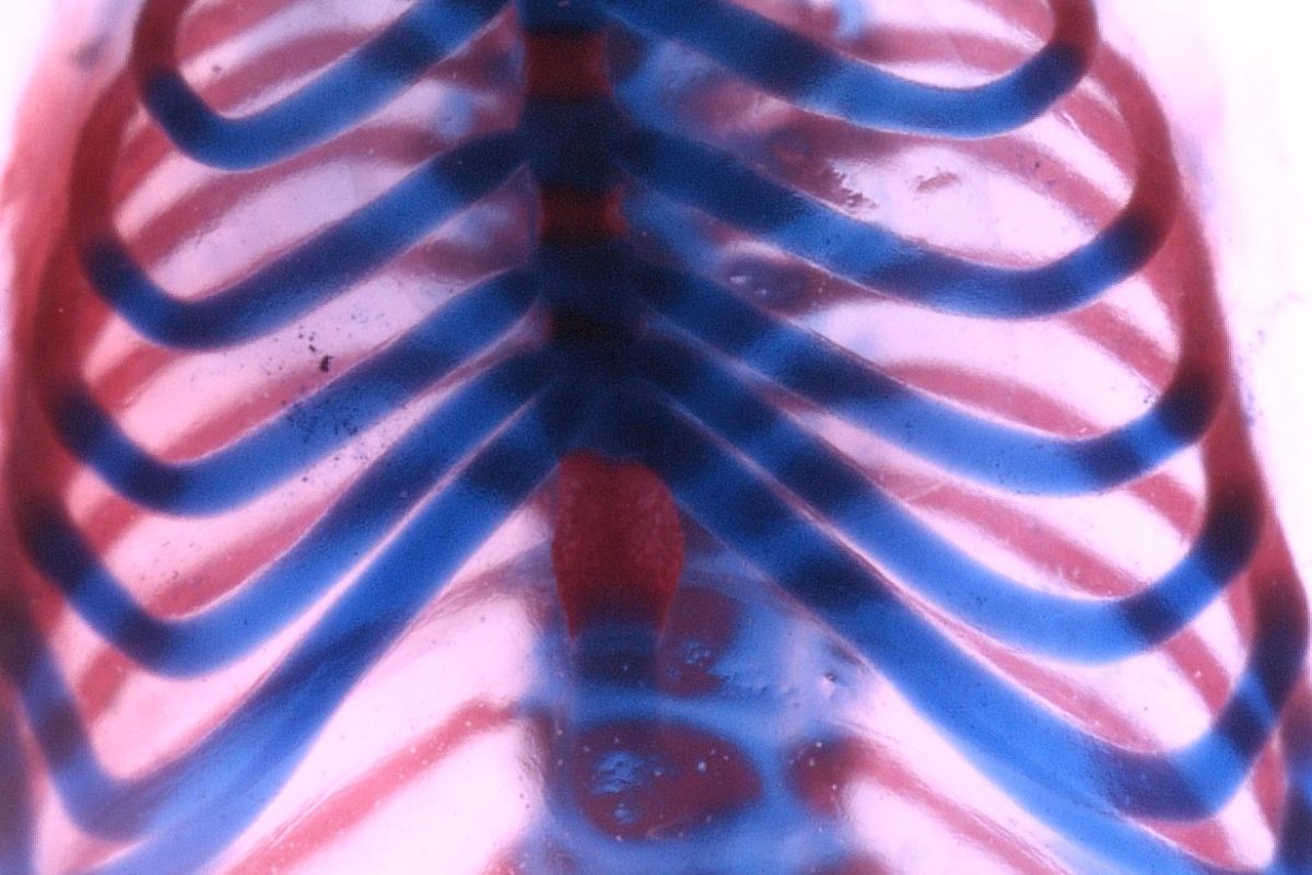 Mouse rib cage stained to show cartilage (blue) and bone (red) (Image by Francesca Mariani)
