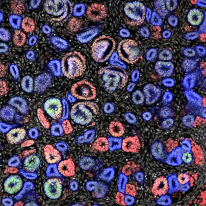 Kidney cells (Image courtesy of the McMahon Lab)