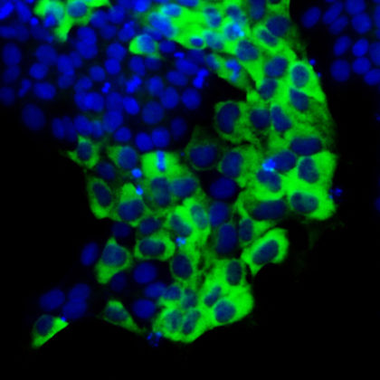The protein TAZ (green) in the cytoplasm (the region outside of the nuclei, blue) promotes the self-renewal of human embryonic stem cells. (Image by Xingliang Zhou)