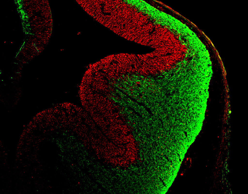Embryonic mouse cortex with neural stem cells (red) and neurons (green) (Image by Wen-Hsuan Chang/Wange Lu Lab)