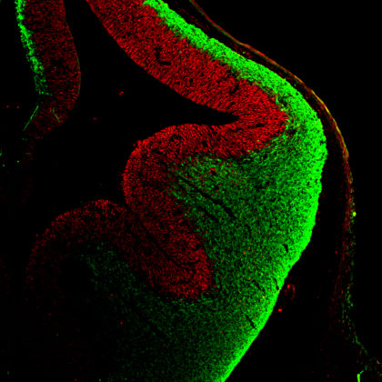 Embryonic mouse cortex with neural stem cells (red) and neurons (green) (Image by Wen-Hsuan Chang/Wange Lu Lab)