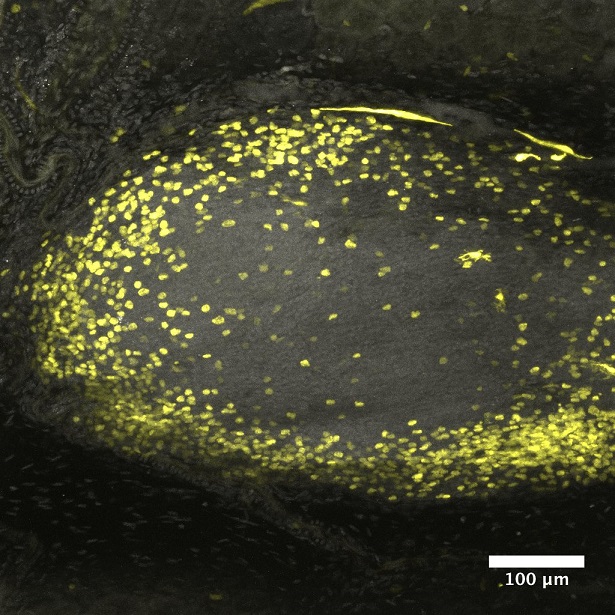 Immune cells (highlighted in yellow) in the mouse colon that are the proposed target of TNFR2-activating therapy in inflammatory bowel disease (IBD) (Image courtesy of D. Brent Polk)