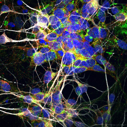 Motor nerve cells (Image courtesy of the Ichida Lab)
