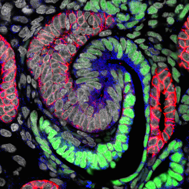 At an early stage, a nephron forming in the human kidney generates an S-shaped structure. Green cells will generate the kidneys’ filtering device, and blue and red cells specialized regions responsible for distinct nephron activities. (Image courtesy of Stacy Moroz and Tracy Tran/McMahon Lab)